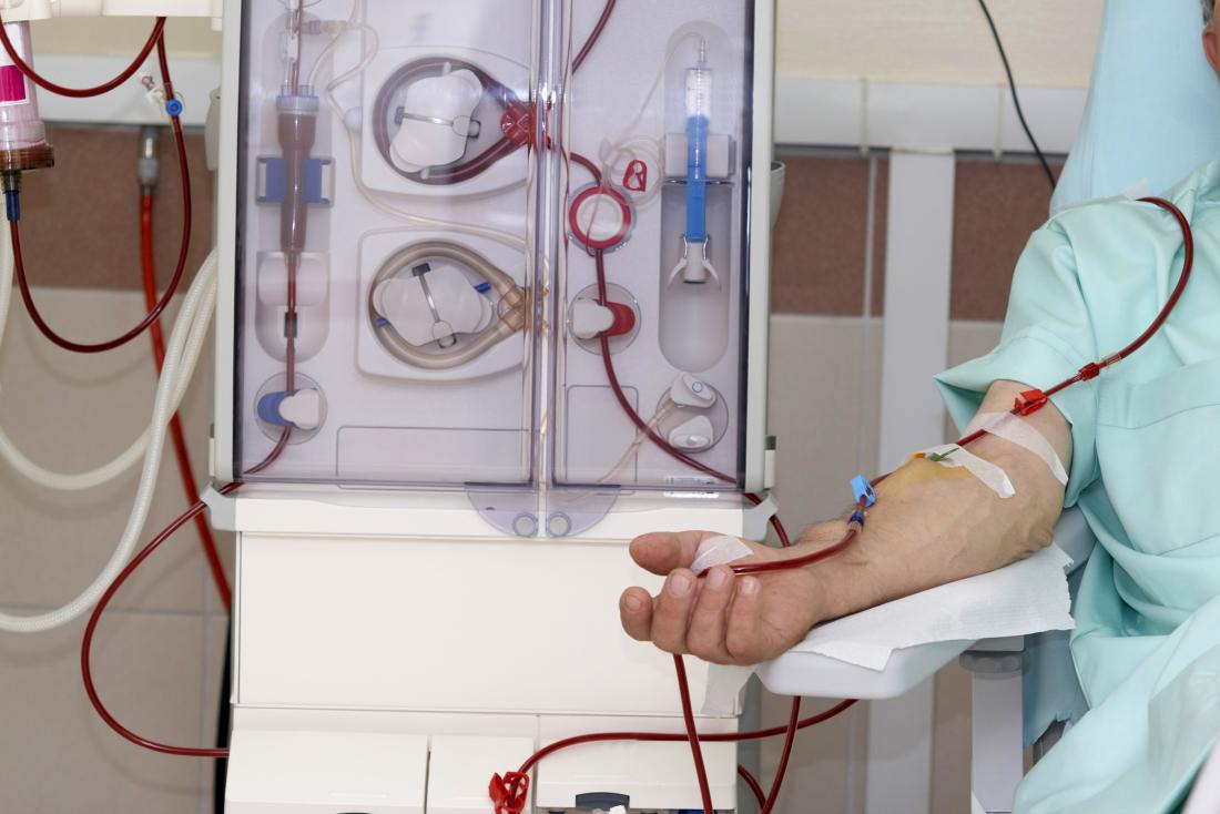 Dialysis Treatment for Kidney Function in Renal Failure