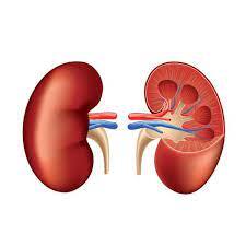  How to get a kidney transplant faster
