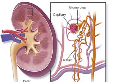 Acute Renal Failure